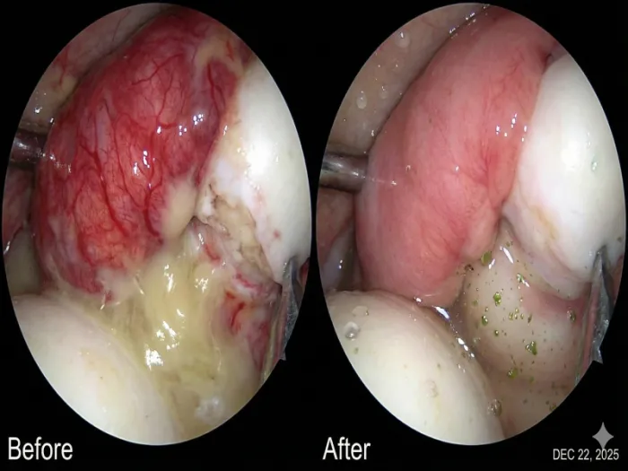 [경고] 무릎이 붓고 뜨거워? 니 관절은 지금 '염증'에 타들어 가는 화재 현장이다 (초록입홍합 오일의 진실)